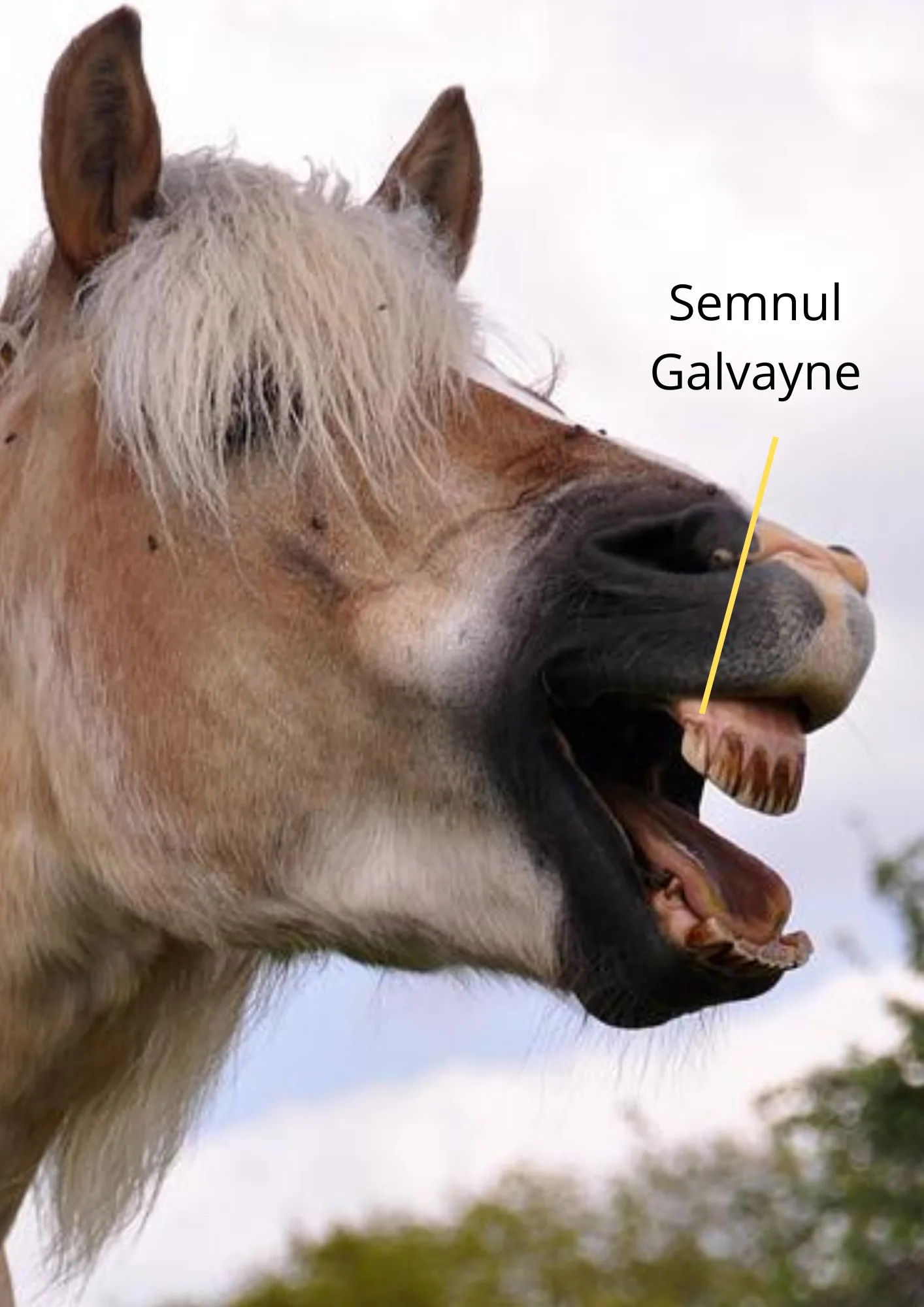 Semnul Galvayne